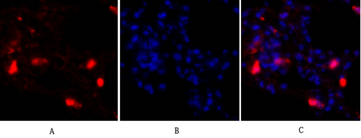 IF - p38 Polyclonal Antibody AP71696